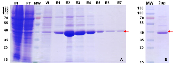 哺乳動物細(xì)胞蛋白表達系統(tǒng)；Protein Expression in Mamalian Cells